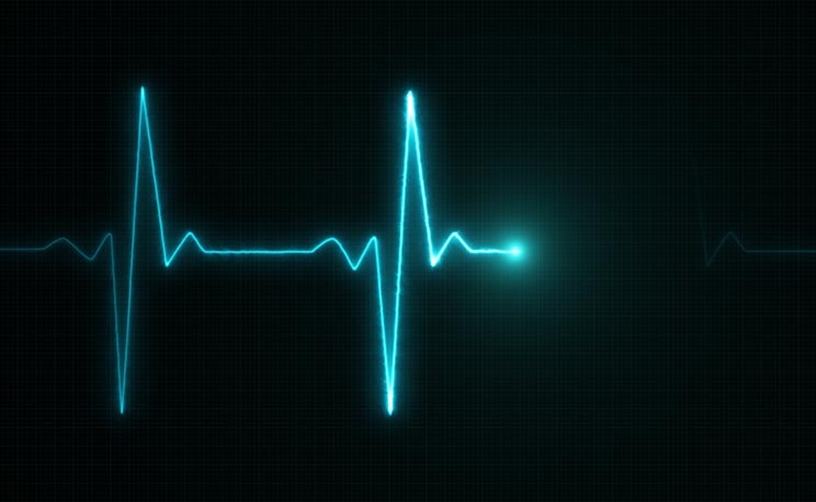 Heart Monitor